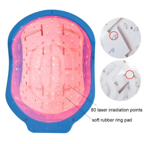 Laser Hair Growth Therapy Helmet - Regrow Your Hair with 80 Point Treatment Cap for Alopecia and Hair Loss